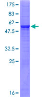 ab165355 on a 12.5% SDS-PAGE stained with Coomassie Blue.