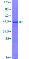 ab166485 on a 12.5% SDS-PAGE stained with Coomassie Blue.