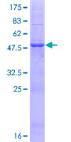 ab165831 on a 12.5% SDS-PAGE stained with Coomassie Blue.