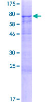 ab163640 on a 12.5% SDS-PAGE stained with Coomassie Blue.