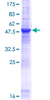 ab165839 on a 12.5% SDS-PAGE stained with Coomassie Blue.