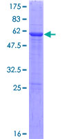 ab163229 on a 12.5% SDS-PAGE stained with Coomassie Blue.