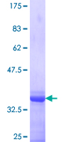 ab163230 on a 12.5% SDS-PAGE stained with Coomassie Blue.