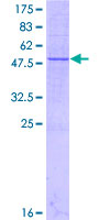 ab161809 on a 12.5% SDS-PAGE stained with Coomassie Blue.
