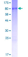 ab162509 on a 12.5% SDS-PAGE stained with Coomassie Blue.