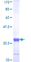 ab166481 on a 12.5% SDS-PAGE stained with Coomassie Blue.