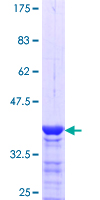 ab158878 on a 12.5% SDS-PAGE stained with Coomassie Blue.