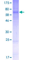 ab164721 on a 12.5% SDS-PAGE stained with Coomassie Blue.