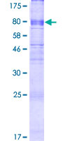 ab162858 on a 12.5% SDS-PAGE stained with Coomassie Blue.