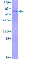 ab158886 on a 12.5% SDS-PAGE stained with Coomassie Blue.