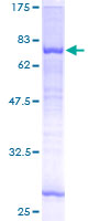 ab158887 on a 12.5% SDS-PAGE stained with Coomassie Blue.