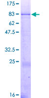 ab158888 on a 12.5% SDS-PAGE stained with Coomassie Blue.