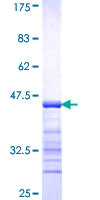 ab158889 on a 12.5% SDS-PAGE stained with Coomassie Blue.