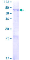 ab165538 on a 12.5% SDS-PAGE stained with Coomassie Blue.