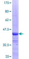 ab164571 on a 12.5% SDS-PAGE stained with Coomassie Blue.