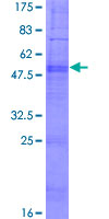 ab164564 on a 12.5% SDS-PAGE stained with Coomassie Blue.