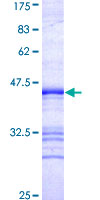 ab164565 on a 12.5% SDS-PAGE stained with Coomassie Blue.