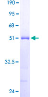 ab164576 on a 12.5% SDS-PAGE stained with Coomassie Blue.