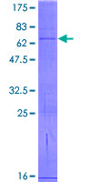 ab164977 on a 12.5% SDS-PAGE stained with Coomassie Blue.