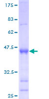 ab165091 on a 12.5% SDS-PAGE stained with Coomassie Blue.