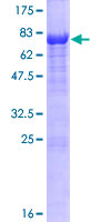 ab165504 on a 12.5% SDS-PAGE stained with Coomassie Blue.