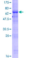 ab166175 on a 12.5% SDS-PAGE stained with Coomassie Blue.