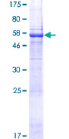 ab166209 on a 12.5% SDS-PAGE stained with Coomassie Blue.