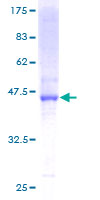 ab163993 on a 12.5% SDS-PAGE stained with Coomassie Blue.