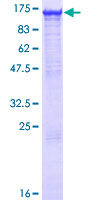 ab153117 on a 12.5% SDS-PAGE stained with Coomassie Blue.