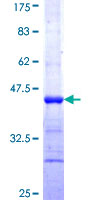 ab153118 on a 12.5% SDS-PAGE stained with Coomassie Blue.