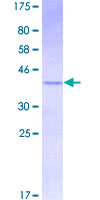 ab158890 on a 12.5% SDS-PAGE stained with Coomassie Blue.