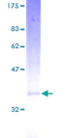 ab158891 on a 12.5% SDS-PAGE stained with Coomassie Blue.