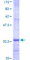 ab158892 on a 12.5% SDS-PAGE stained with Coomassie Blue.