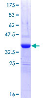 ab153455 on a 12.5% SDS-PAGE stained with Coomassie Blue.