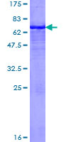 ab158893 on a 12.5% SDS-PAGE stained with Coomassie Blue.