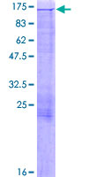 ab163878 on a 12.5% SDS-PAGE stained with Coomassie Blue.