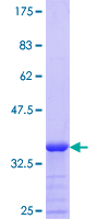 ab163879 on a 12.5% SDS-PAGE stained with Coomassie Blue.