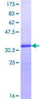 ab160594 on a 12.5% SDS-PAGE stained with Coomassie Blue.