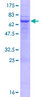 ab158894 on a 12.5% SDS-PAGE stained with Coomassie Blue.