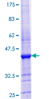 ab158895 on a 12.5% SDS-PAGE stained with Coomassie Blue.