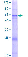 ab162068 on a 12.5% SDS-PAGE stained with Coomassie Blue.