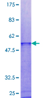ab163633 on a 12.5% SDS-PAGE stained with Coomassie Blue.