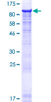 ab162771 on a 12.5% SDS-PAGE stained with Coomassie Blue.