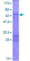 ab158881 on a 12.5% SDS-PAGE stained with Coomassie Blue.