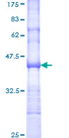 ab158882 on a 12.5% SDS-PAGE stained with Coomassie Blue.