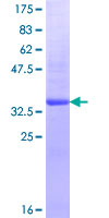 ab160547 on a 12.5% SDS-PAGE stained with Coomassie Blue.