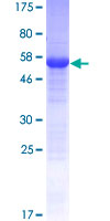 ab163131 on a 12.5% SDS-PAGE stained with Coomassie Blue.