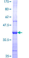 ab158897 on a 12.5% SDS-PAGE stained with Coomassie Blue.