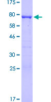 ab165518 on a 12.5% SDS-PAGE stained with Coomassie Blue.