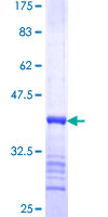 ab165519 on a 12.5% SDS-PAGE stained with Coomassie Blue.